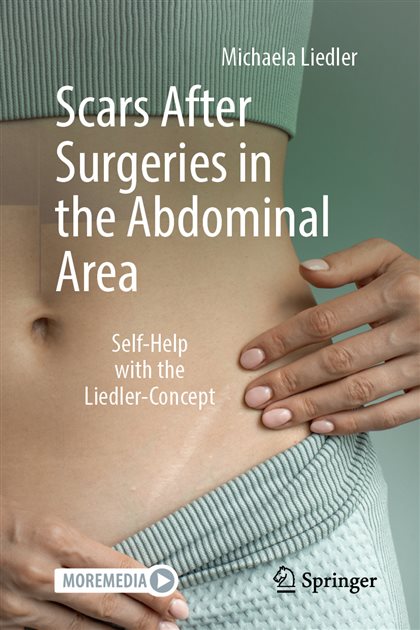 Scars After Surgeries in the Abdominal Area: Self-Help with the Liedler-Concept, Michaela Liedler, 9783662713778, 9783662713761, 978-3662713778, 978-3662713761