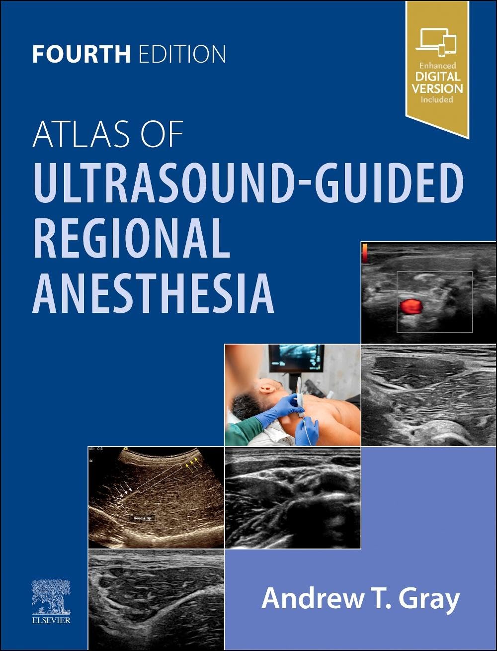 Atlas of Ultrasound-Guided Regional Anesthesia 4th Edition